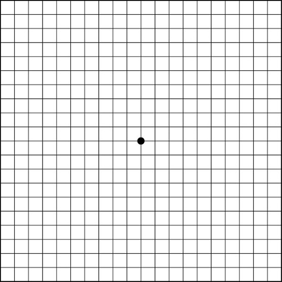 阿姆斯勒方格表 (Amsler Grid) 阿姆斯勒方格表 (Amsler Grid)