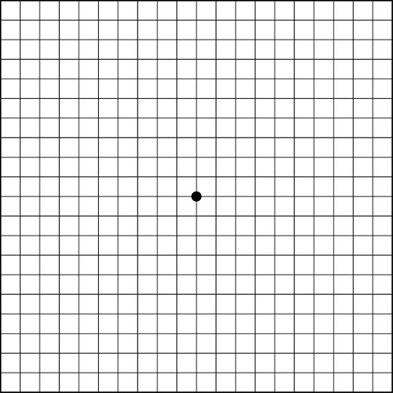 阿姆斯勒方格表 (Amsler Grid)